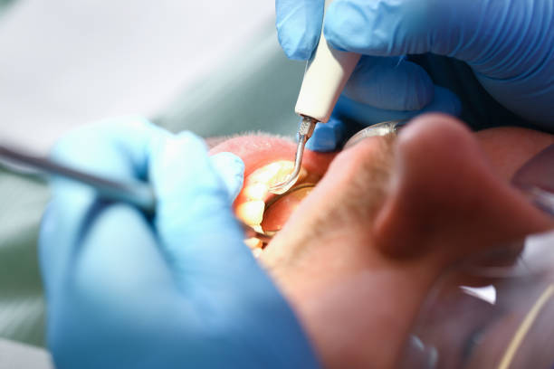 Best Emergency Cosmetic Dentistry (e.g., broken veneers) in Trenton, TN